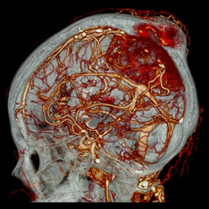 Aquilion PRIME 160 CT scan