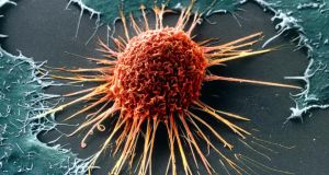 Systems Biology Ireland is designing new cancer treatments based on a systems-level, mechanistic understanding of cellular networks